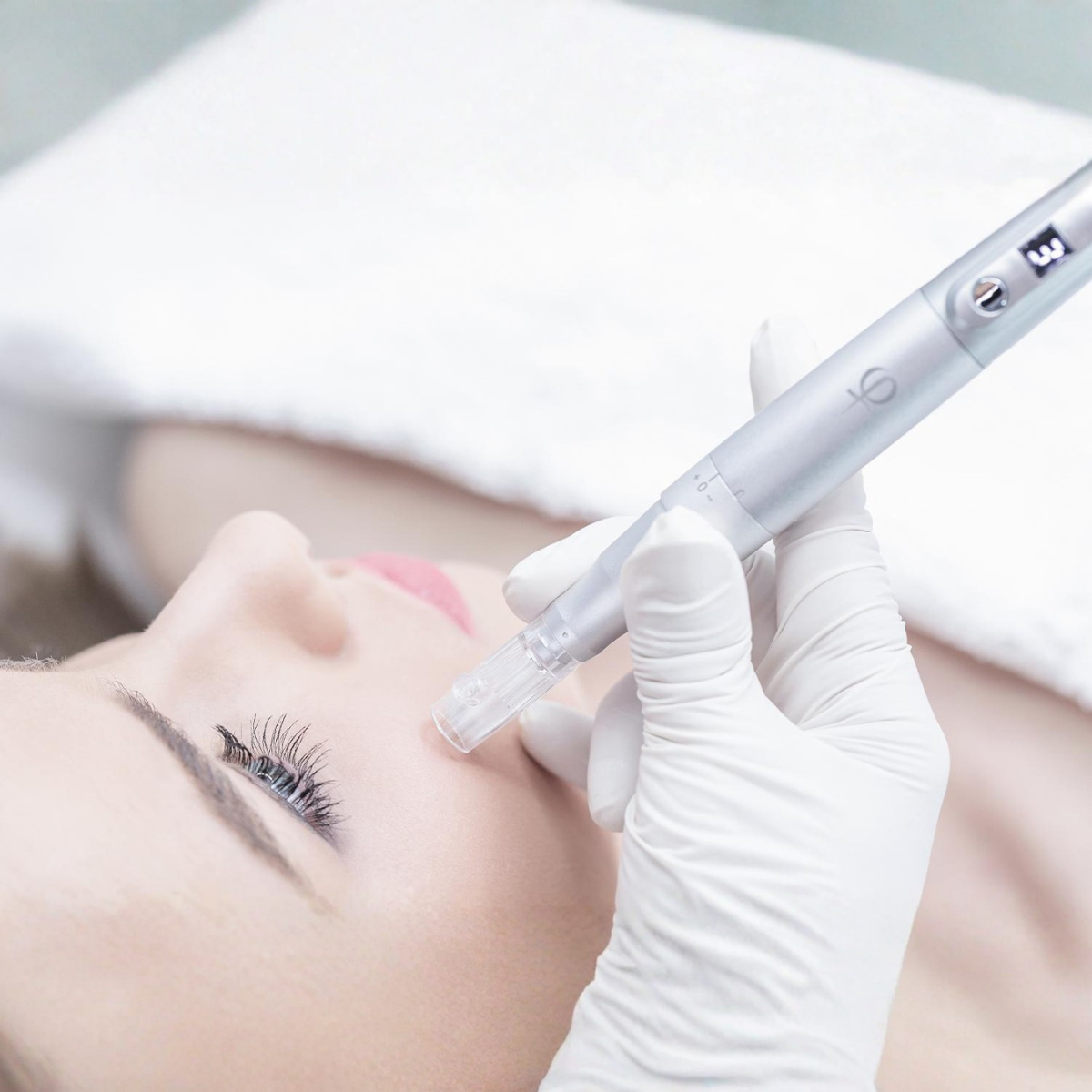 Microneedling