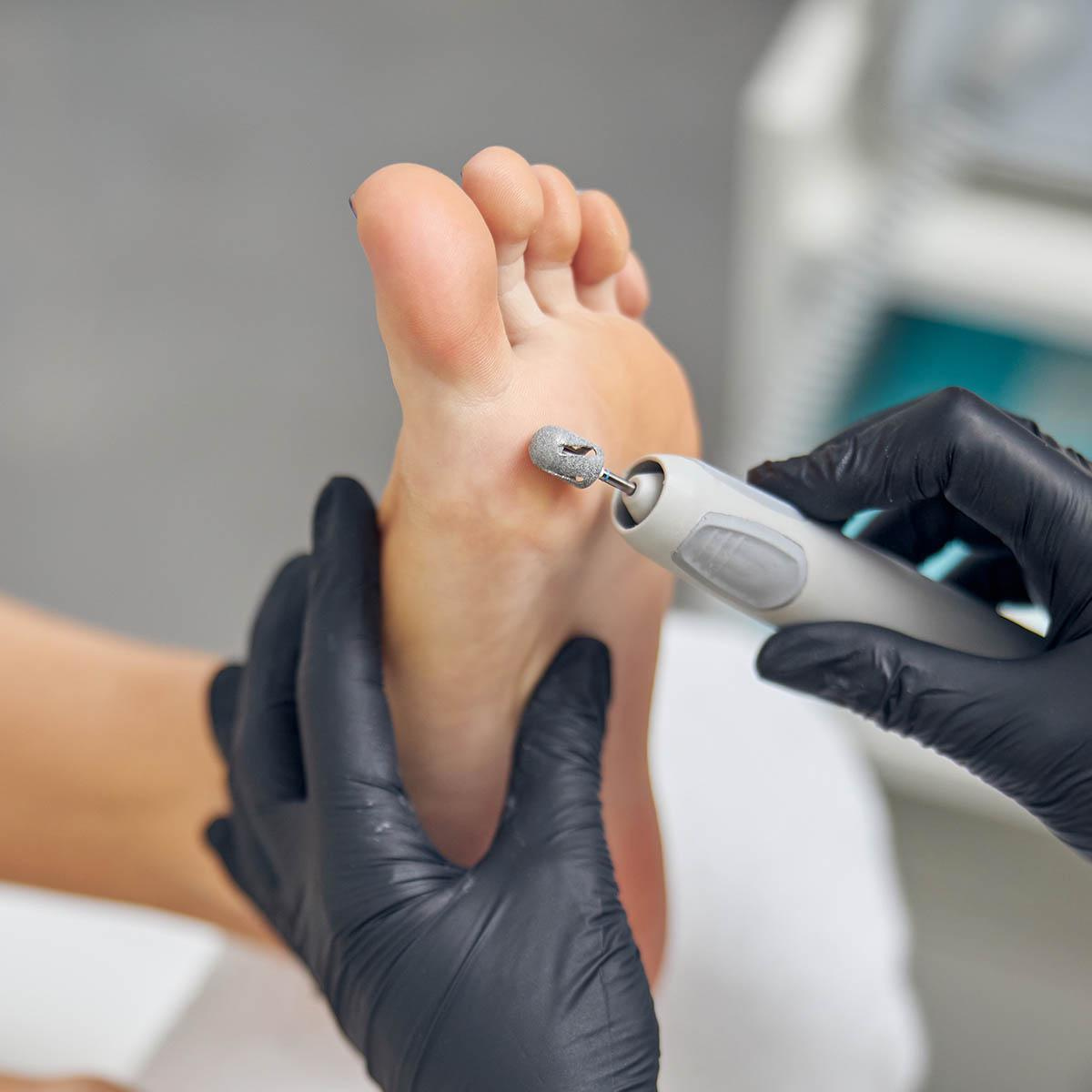 Pedicure tecnica
